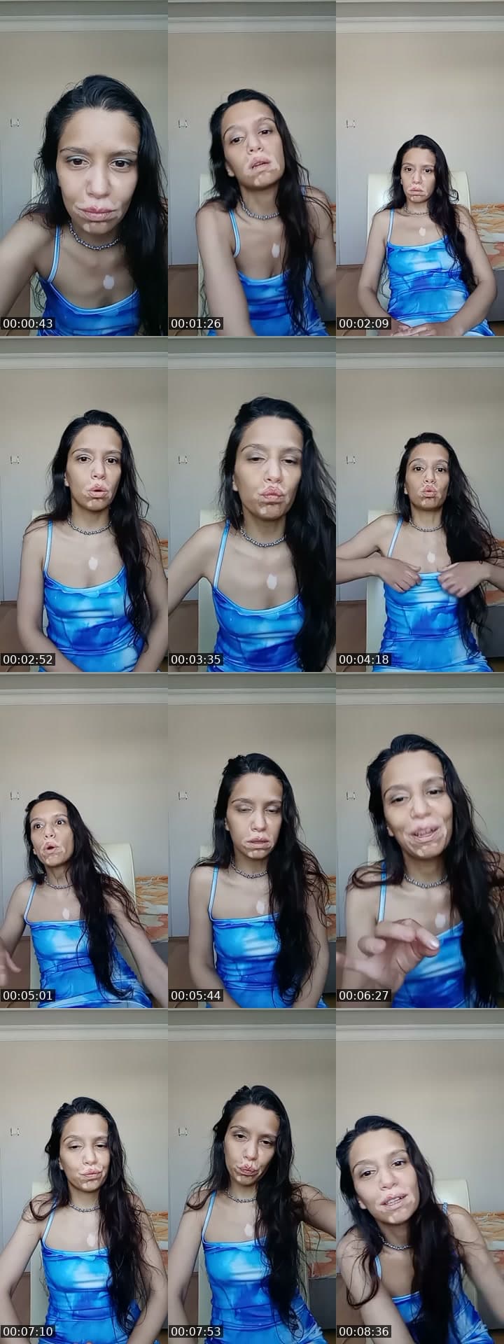@vitiligo.babe TikTok live stream