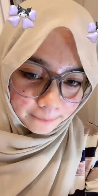 @fadilanrdn TikTok live stream