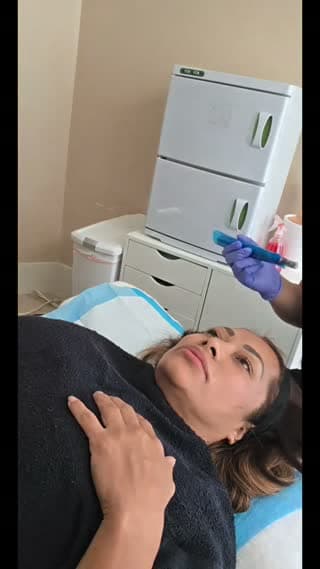 @chipis881 TikTok live stream